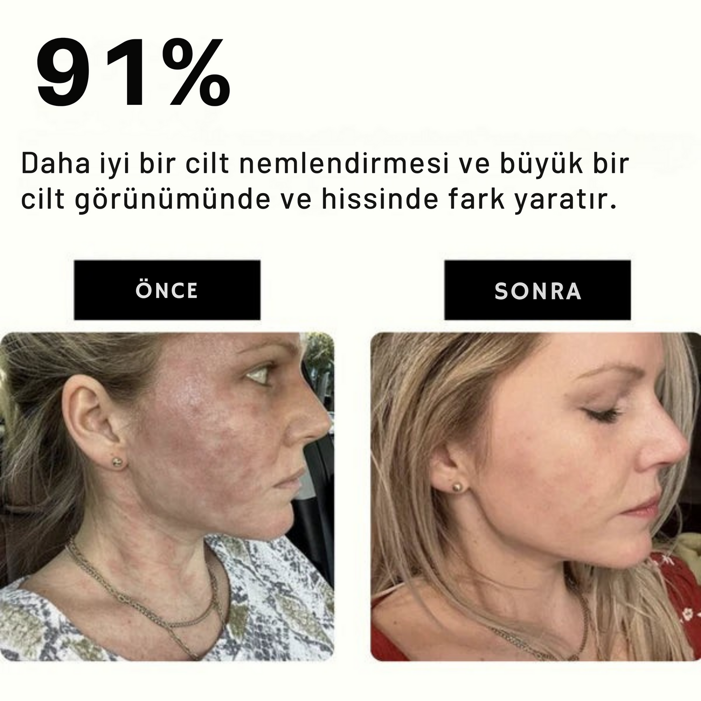 Filtreli Duş Başlığı