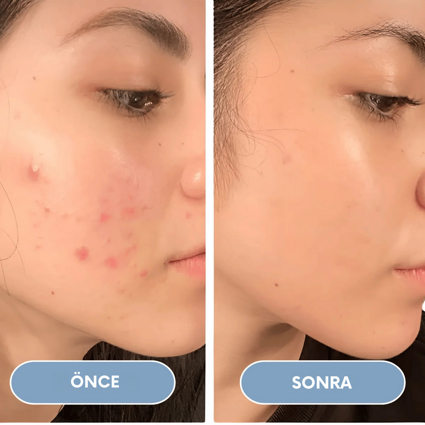 Filtreli Duş Başlığı